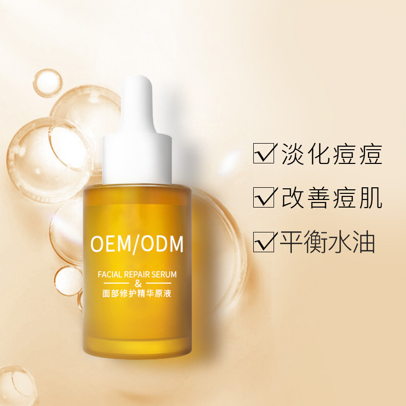 防城港市_祛痘精华原液OEM